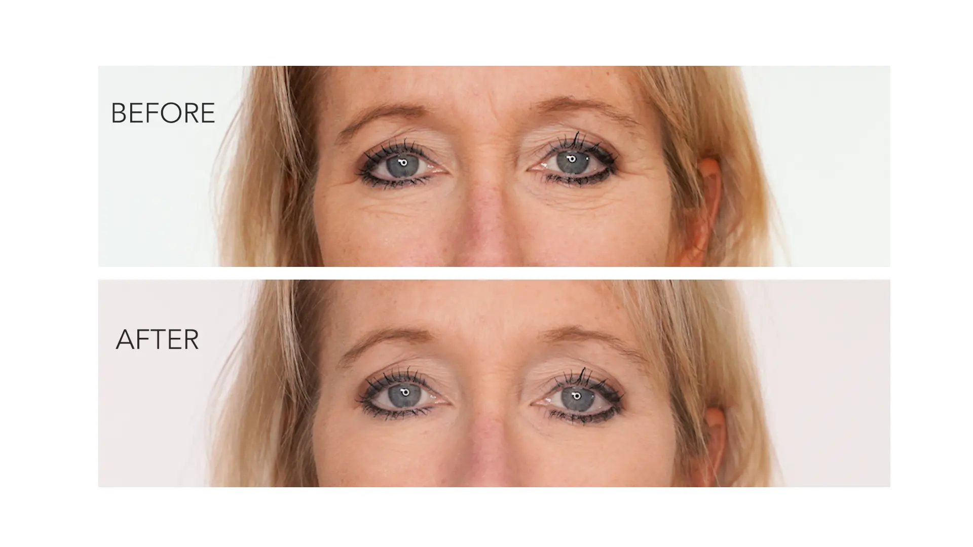 Amy's eye area before and after the Instant Under-Eye Treatment